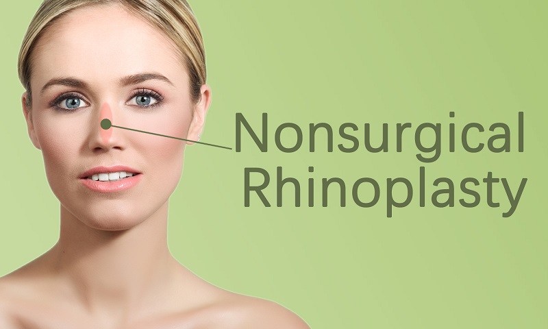 Nonsurgical Rhinoplasty in Surat