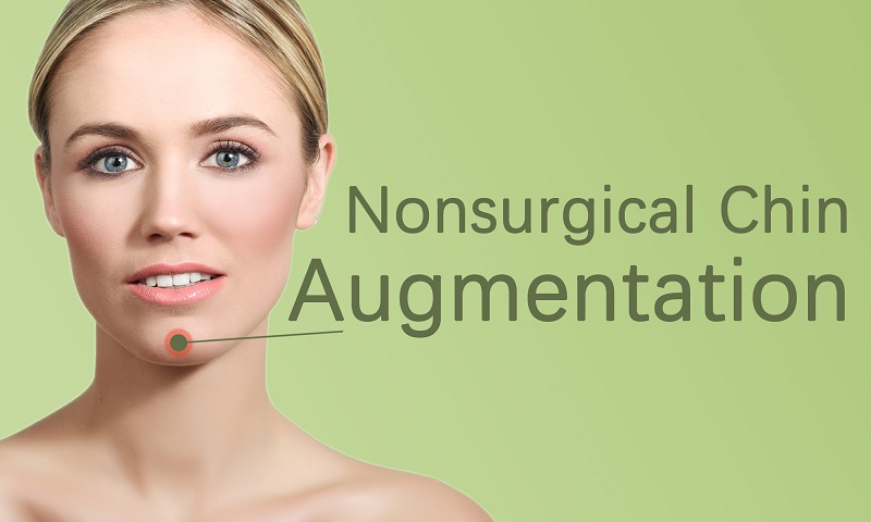 Nonsurgical Chin Augmentation in Surat