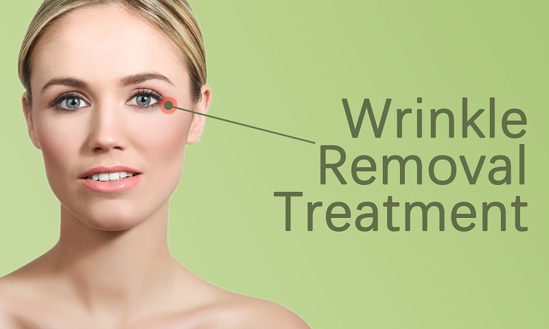 Wrinkle Removal Treatment in Surat